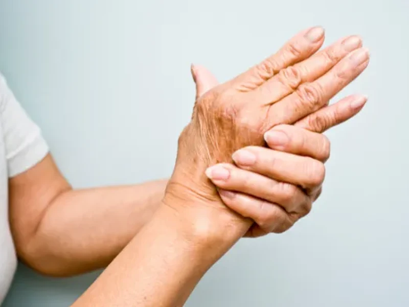 Arthritis treatment