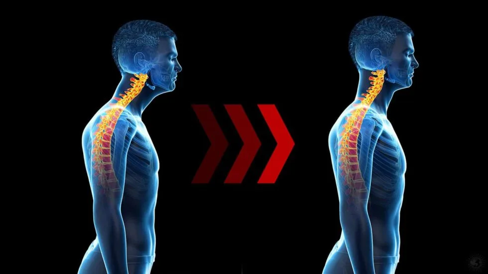 Text Neck: How Can Physical Therapy Help?
